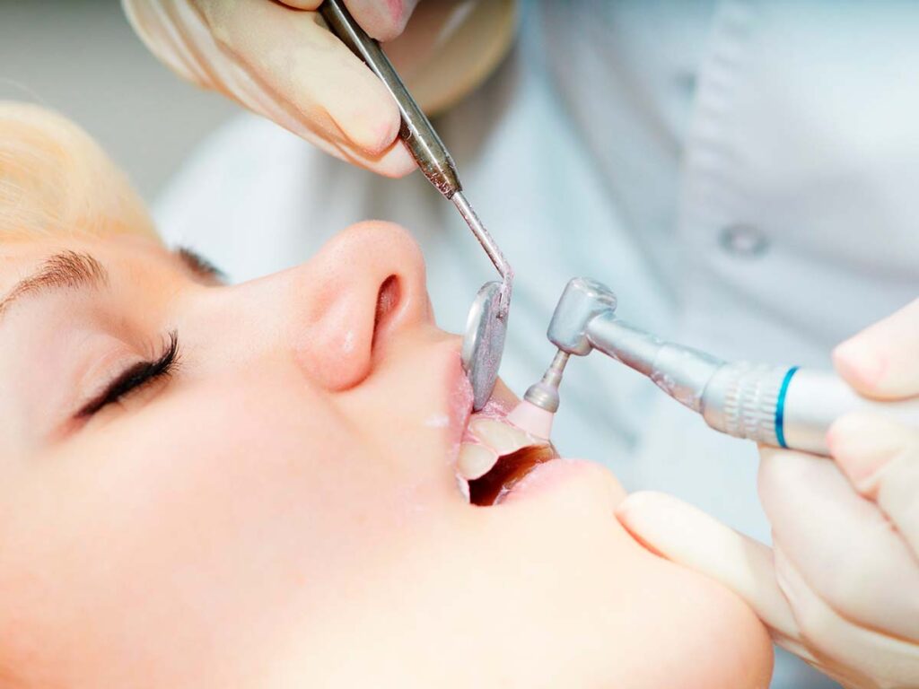 Quatro razões para você fazer a limpeza dental no dentista