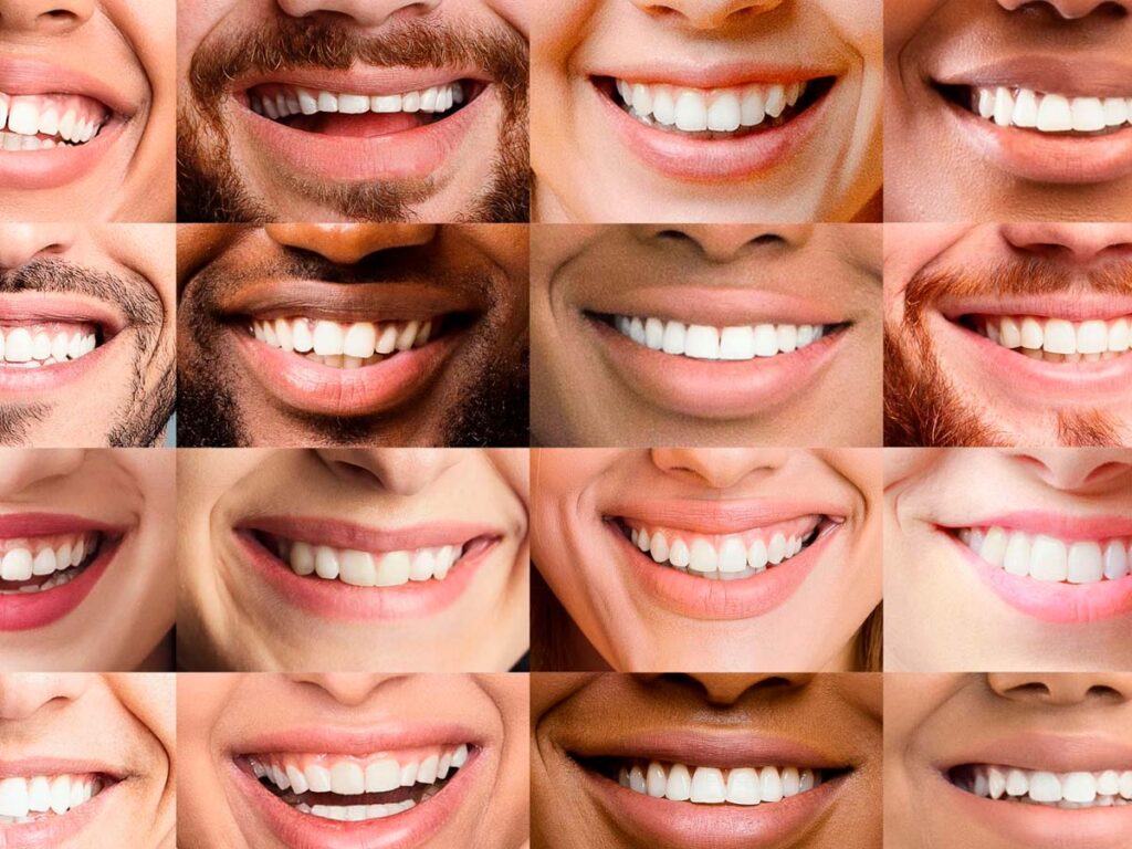 O que representa o sorriso em diferentes culturas